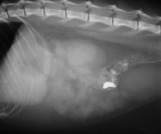 Ngoại vật trong đường tiêu hóa